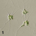 Amoeboid cells of Lotharella amoeboformis