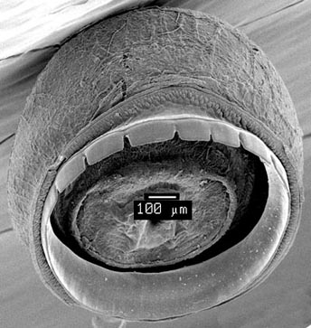 SEM_photograph_of_arm__III_sucker.