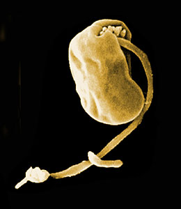 Scanning electron micrograph of Ancyromonas sigmoides