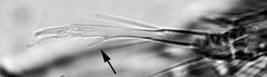 Nellosana male tarsal 'spur'